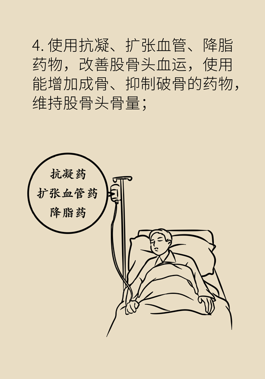 激素會(huì)帶來股骨頭壞死的后遺癥嗎？