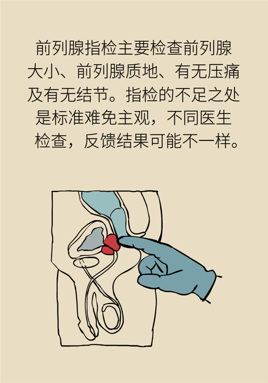 前列腺肥大了還能縮小嗎？