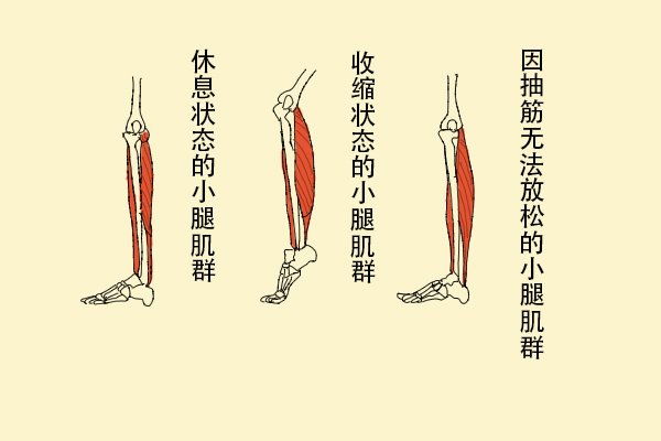 為什么缺鈣會導(dǎo)致抽筋？