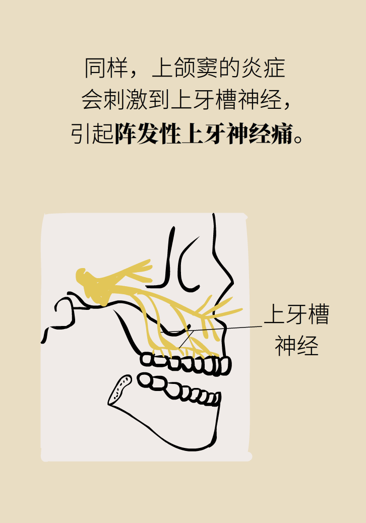 為什么鼻竇發(fā)炎，疼的卻是頭、眼和牙？