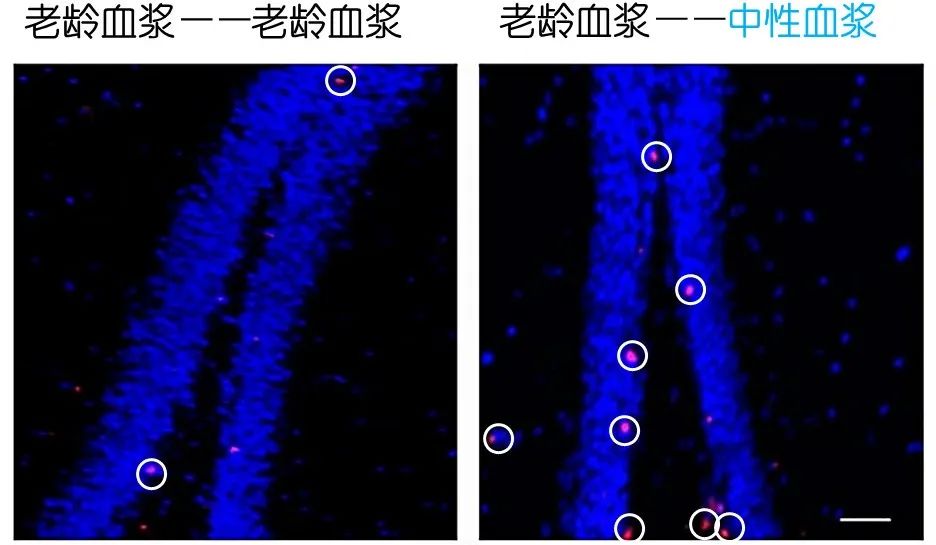 重返年輕不用大換血，只要給血液“兌點(diǎn)水”？