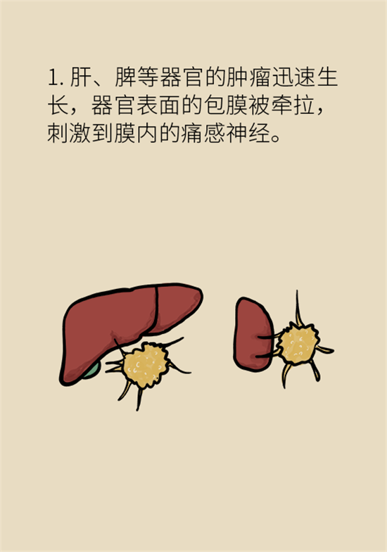 癌癥到底有多痛？需要注意這7個重點問題