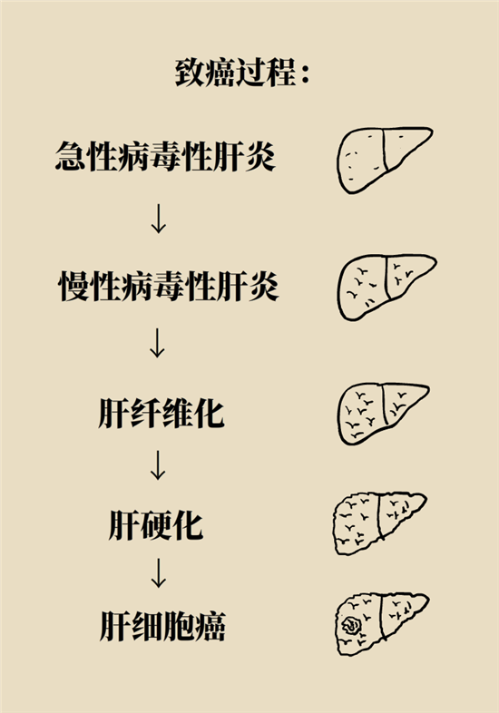 癌癥會傳染嗎？專家：這些高危因素得注意