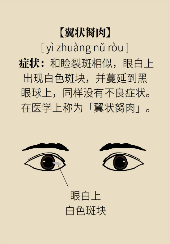 眼白有斑塊、出血要緊嗎？專家：名字唬人但問題不大