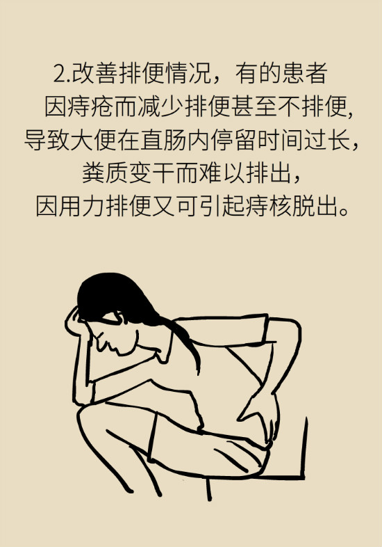 長(zhǎng)“痔”如何久安？專家的建議來了