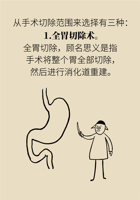 胃癌手術(shù)一定要全切胃？專家：視情況而定