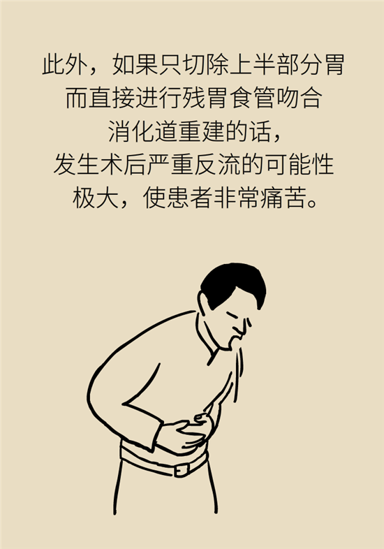 胃癌手術(shù)一定要全切胃？專家：視情況而定