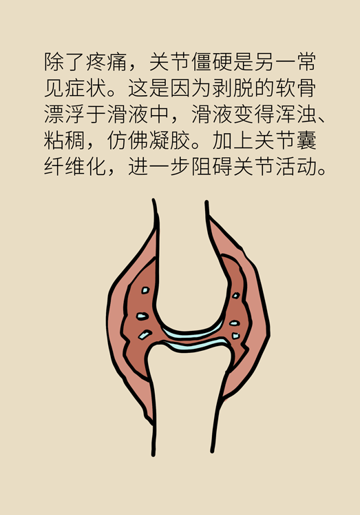 人老關節(jié)也會老嗎？