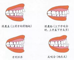 兒童換牙常見3大問(wèn)題，保護(hù)牙齒需要做好這5點(diǎn)