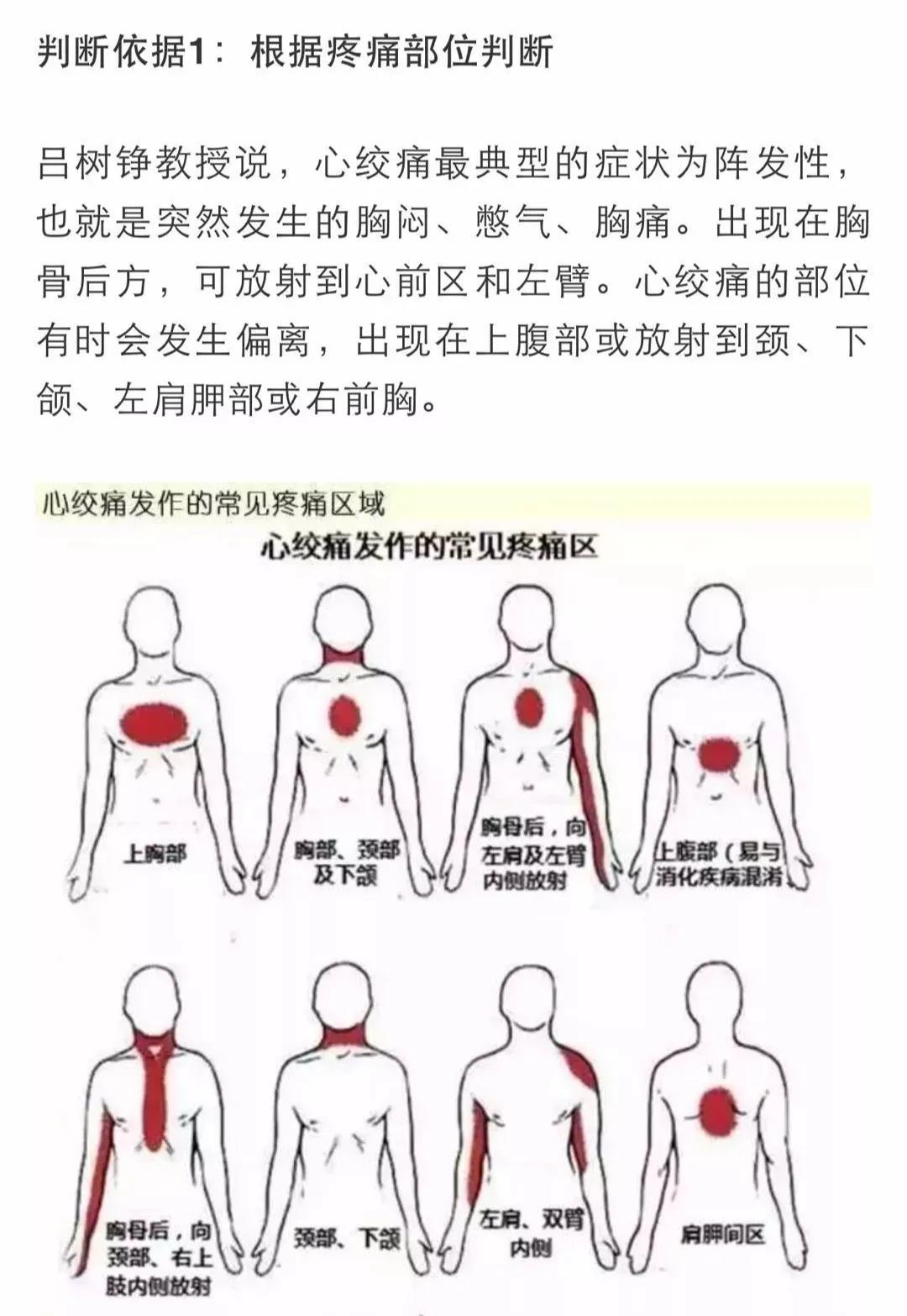 心梗有前兆！心臟發(fā)出的警報你在意了嗎？