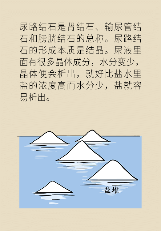 尿結石科普動漫