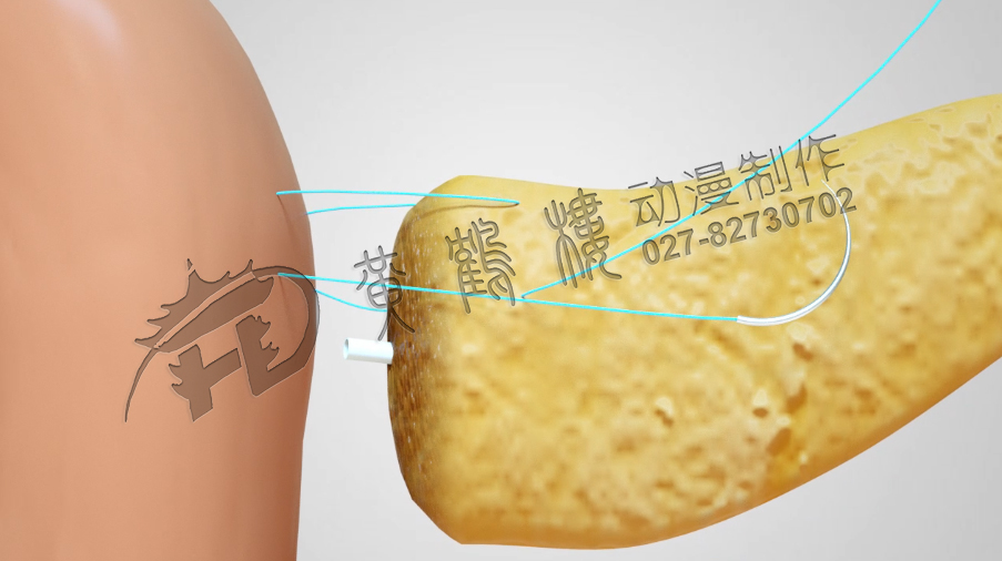 武漢醫(yī)學(xué)制作動畫公司.jpg