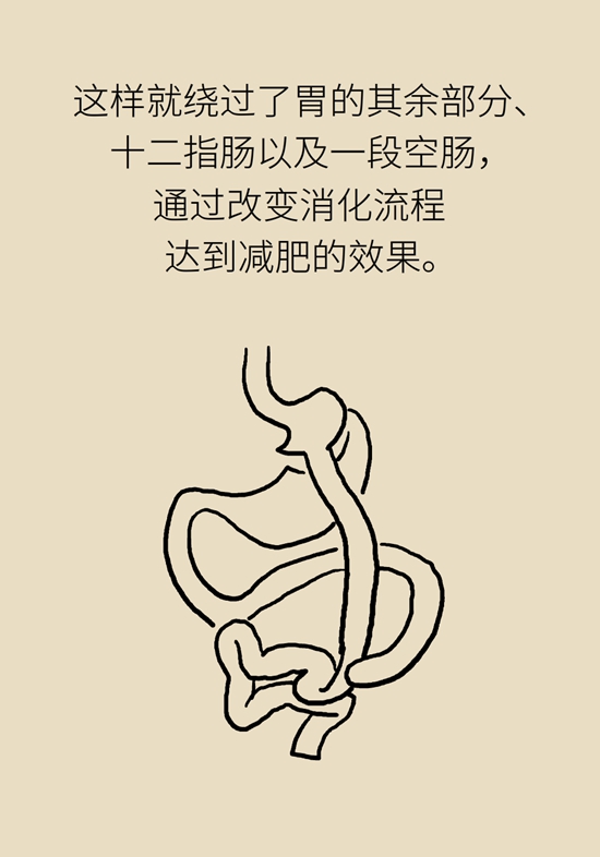 減肥醫(yī)學(xué)知識(shí)科普