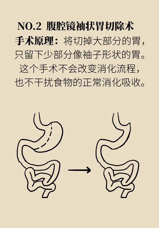 減肥醫(yī)學(xué)知識(shí)科普