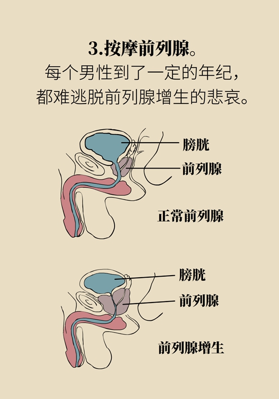 怎么做可以預(yù)防痔瘡呢？按摩前列腺、鍛煉盆底肌