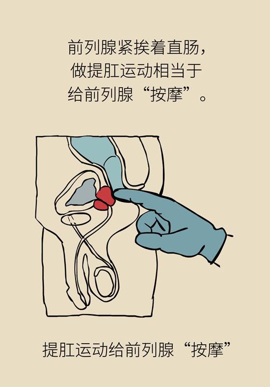 怎么做可以預(yù)防痔瘡呢？按摩前列腺、鍛煉盆底肌